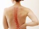 Упражнения для спины при заболевании сколиозом или его профилактике